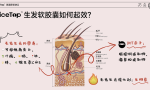 NiceTop所先养发胶囊双管齐下 从根源解决脱发难题